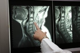 Radiografía do pescozo