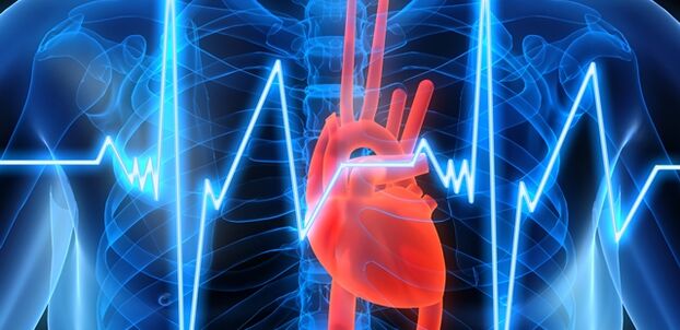 A osteocondrose torácica pode ir acompañada dunha sensación de dor na zona do corazón. 