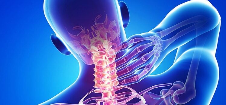Osteocondrose da columna cervical